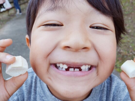 乳歯と永久歯の生え変わり